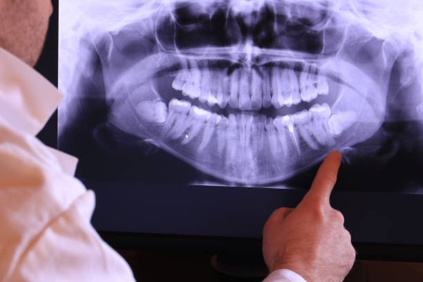 Best Emergency Dentist for Knocked-Out Tooth in St Ignace, MI